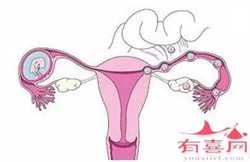 南京代孕单价-南京代孕哪家最好-二胎取环六个月没怀孕正常吗